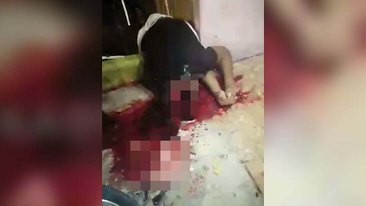 【閲覧注意】銃で撃たれた頭が縦に割れて死亡した男性のグロ動画。