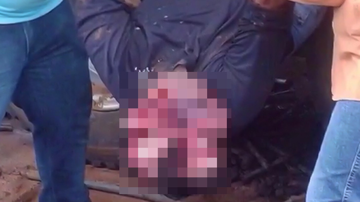 【閲覧注意】牽引ロープが外れて飛んできた金具に顔を潰されて死んでしまった男性のグロ動画。