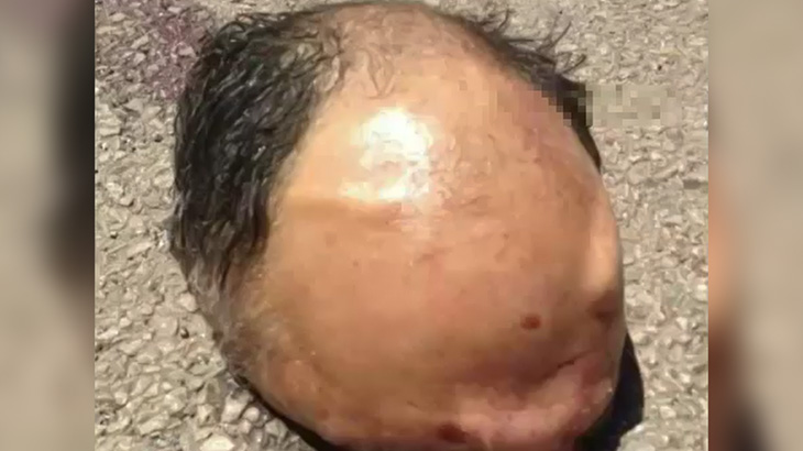 【閲覧注意】事故で死亡した男性、あまりにも頭をキレイに切断されてしまったグロ動画。