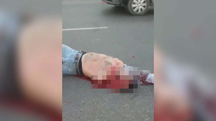 【閲覧注意】トラックに轢かれた男性、頭が割れて左腕がちぎれてしまったグロ動画。