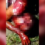 【閲覧注意】マチェーテで顔を深く切られてしまった男性が辛うじてまだ生きているグロ動画。