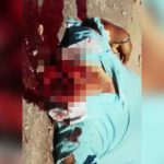 【閲覧注意】事故で顔が千切れてしまった男性の死体映像。