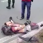 【閲覧注意】バイク事故で脚を切断されてしまった男性のグロ動画。