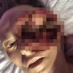 【閲覧注意】左眼が腐ってウジが湧いてしまった女性のグロ動画。