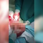 【衝撃映像】男性の腸からとんでもない大きさのディルドを摘出して笑い声を上げる医者たち。