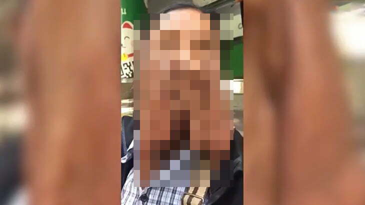 【衝撃映像】顔の皮膚がデロデロに溶けてしまったおばあちゃん。