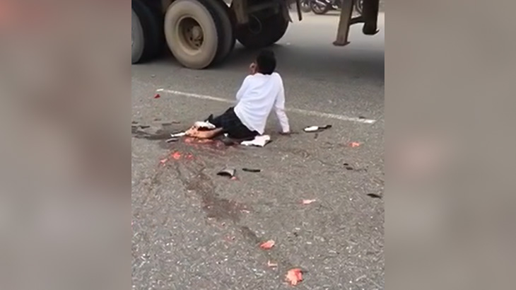 【閲覧注意】事故で放心状態の女性とグチャグチャになった人間のグロ動画。