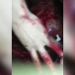 【閲覧注意】頭がグニャグニャになるほどナイフで刺されまくって殺された男のグロ動画。