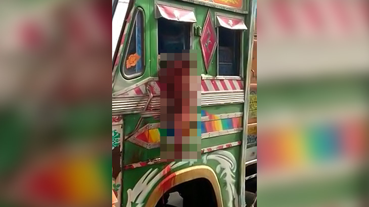 【閲覧注意】頭が割れた男性を助手席に乗せたまま走るトラックの映像。