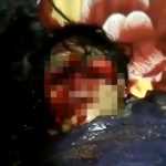 【超！閲覧注意】顔を横に切り裂かれた女性が辛うじて生きているグロ動画。