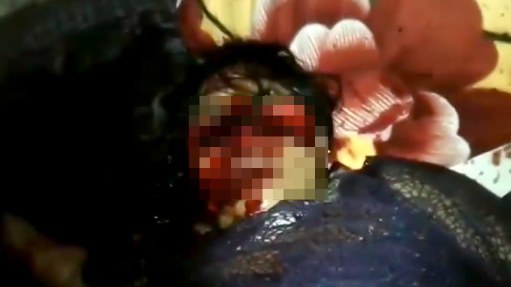 超 閲覧注意 顔を横に切り裂かれた女性が辛うじて生きているグロ動画 カルマニマ