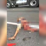 【閲覧注意】事故で左脚グチャグチャ、右腕が切断された男性の死体映像。