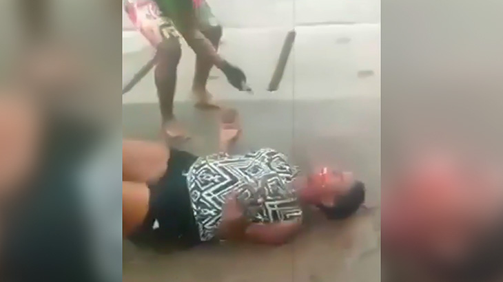 【閲覧注意】マチェーテで歯を叩き折られてしまう女性の映像。