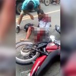 【閲覧注意】バイク事故で左腕が肩から切断されてしまった男のグロ動画。