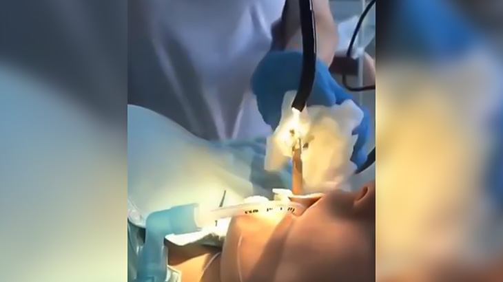 野外で寝ていた女性の口に蛇が入り込んでしまった映像。