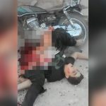 【閲覧注意】空爆で下半身を破壊された男性が辛うじて生きているグロ動画。