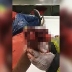 【閲覧注意】デモ活動中に手榴弾を投げようとして右手を破壊されてしまった男性のグロ動画。