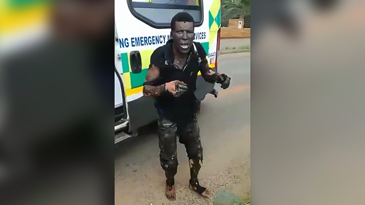 高電圧ケーブルを盗もうとして感電して全身大やけどした男の映像。