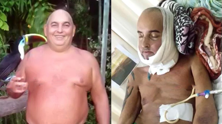 【閲覧注意】喫煙者の男性が舌癌を発症してから弱っていく?像が怖すぎる･･･。