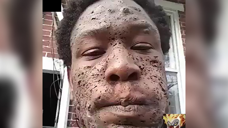 【微閲覧注意】顔に無数の小さな穴がある男の自撮り?像。