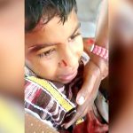 【閲覧注意】バスの窓から右腕を出していて切断されてしまった男の子の映像。