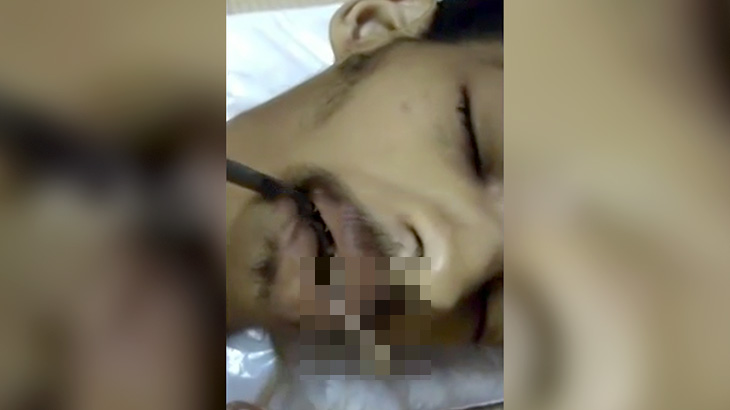 【閲覧注意】口から寄生虫が這い出している男性死体の映像。