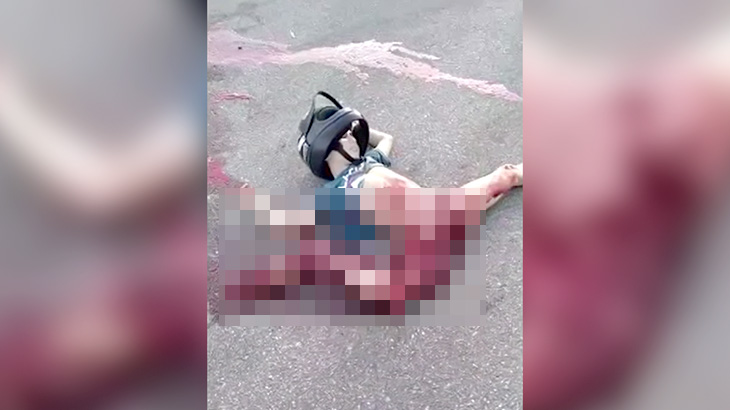 【閲覧注意】バイク事故で右脚グチャグチャ、腸が剥き出しになってしまったグロ動画。