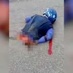 【閲覧注意】バイク事故で胴体を切断されてしまった男性のグロ動画。