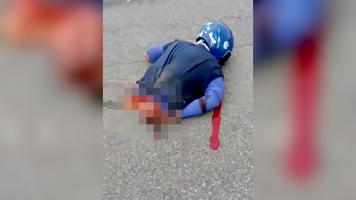 【閲覧注意】バイク事故で胴体を切断されてしまった男性のグロ動画。