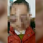 【閲覧注意】18歳の中国人男性の顔がヤベーことになってしまった映像。