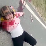 【閲覧注意】バイク事故で右腕が肩から切断されてしまった女性の映像。