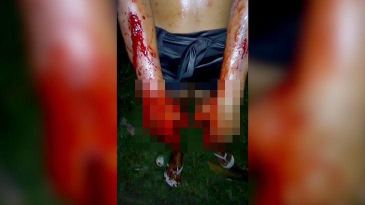 盗みを働いた女の子が罰として “両手をハンマーで殴られまくる刑” に処されてしまう映像。