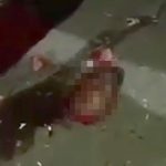 【閲覧注意】事故で剥がれてしまった男性の顔。