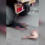 【閲覧注意】トラックに右脚を切断されてしまった女性のグロ動画。