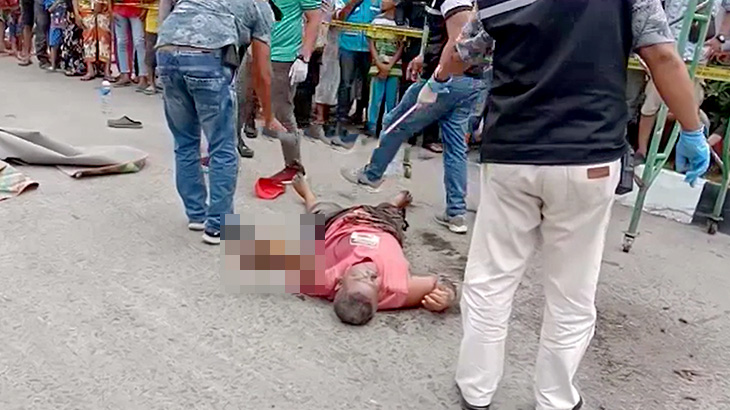 【閲覧注意】感電して左腕が焼け切れてしまった男性の死体映像。