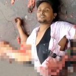 【閲覧注意】事故で下半身が切断されてグッチャグチャになった男性のグロ動画。