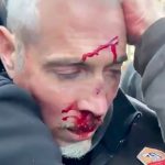 バイデン支持者の男に殴られて血を流すトランプ支持者の男性の映像。