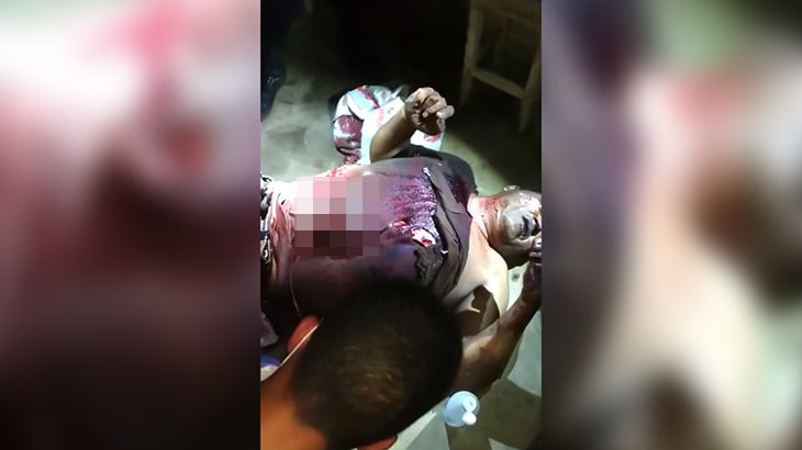 【閲覧注意】刺された腹から内臓が飛び出してしまった男性のグロ動画。