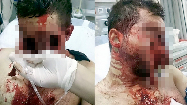 【閲覧注意】シートベルトをせずに事故った男性の顔がヤバいことになってしまったグロ画像。