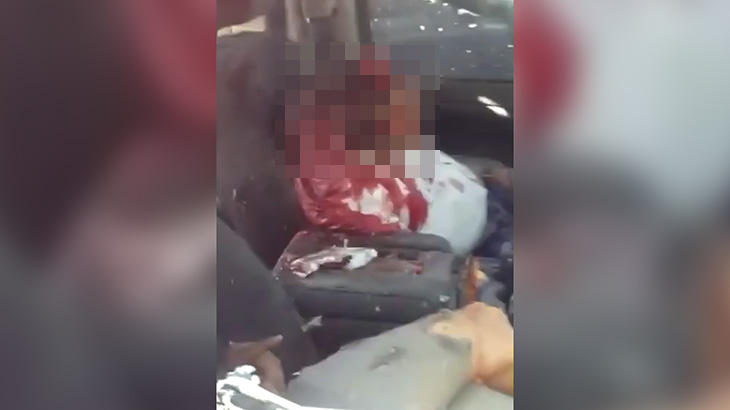 【閲覧注意】銃で撃たれまくって頭がグニャグニャになってしまった男性の死体映像。