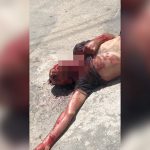 【閲覧注意】喉を刺された男性が苦しそうな声を上げる映像。