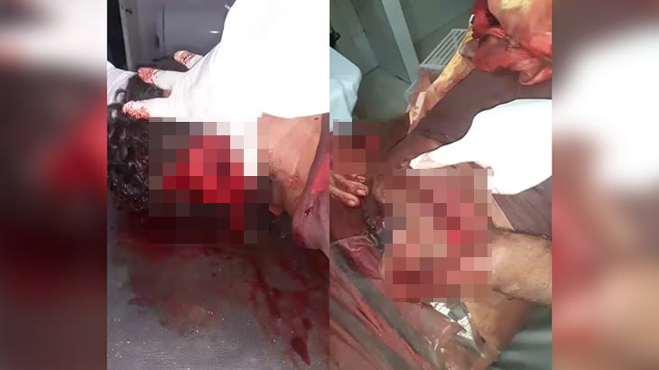 【閲覧注意】マチェーテで殺された男性の死体を病院で撮影したグロ動画。