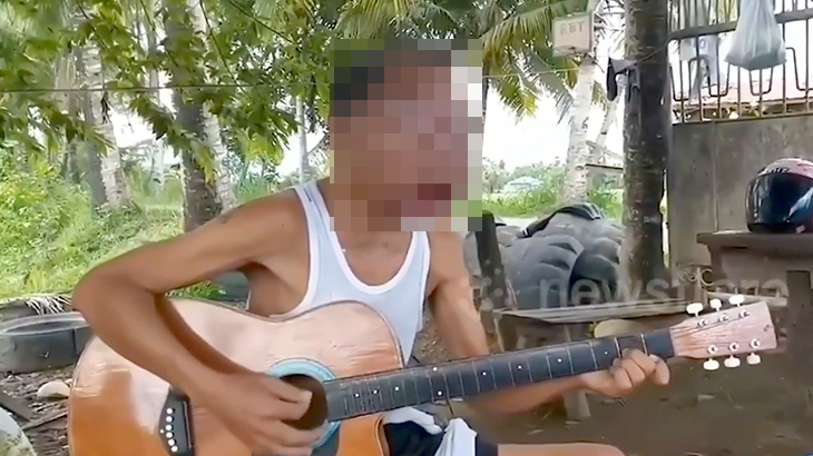 顔が異様に腫れ上がった男がギターを演奏する映像。