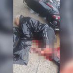 【閲覧注意】バイク事故で左脚がちぎれてしまった男性の?像。