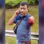 【閲覧注意】事故で左腕がちぎれた状態で普通に電話する男の映像。