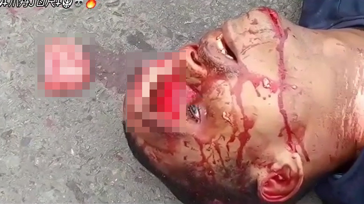 【閲覧注意】おでこが割れて脳が飛び出している男性の死体映像。