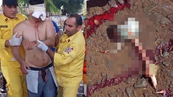 【閲覧注意】「幽霊が見えてしまう」ので目玉を引っこ抜いた男のグロ画像。