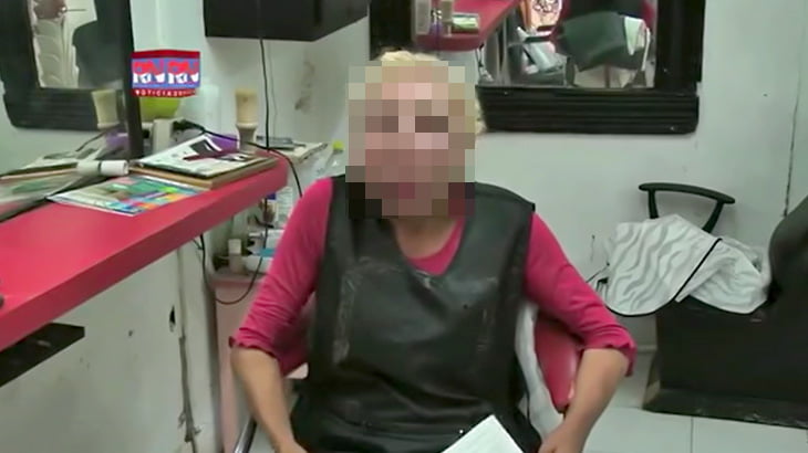 「シワ取り」ヒアルロン酸注射で顔がとんでもないことになってしまった女性の映像。