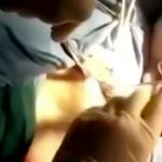 女性の腹からウナギを摘出する手術映像。