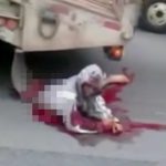 【閲覧注意】トラックに轢かれて胴体切断されたけど結構生きてる男のグロ動画。